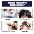 ScalpHealDiscover ScalpHeal™ Hair Growth Spray for thicker, healthier hair. Boost your hair growth naturally with our powerful formula.