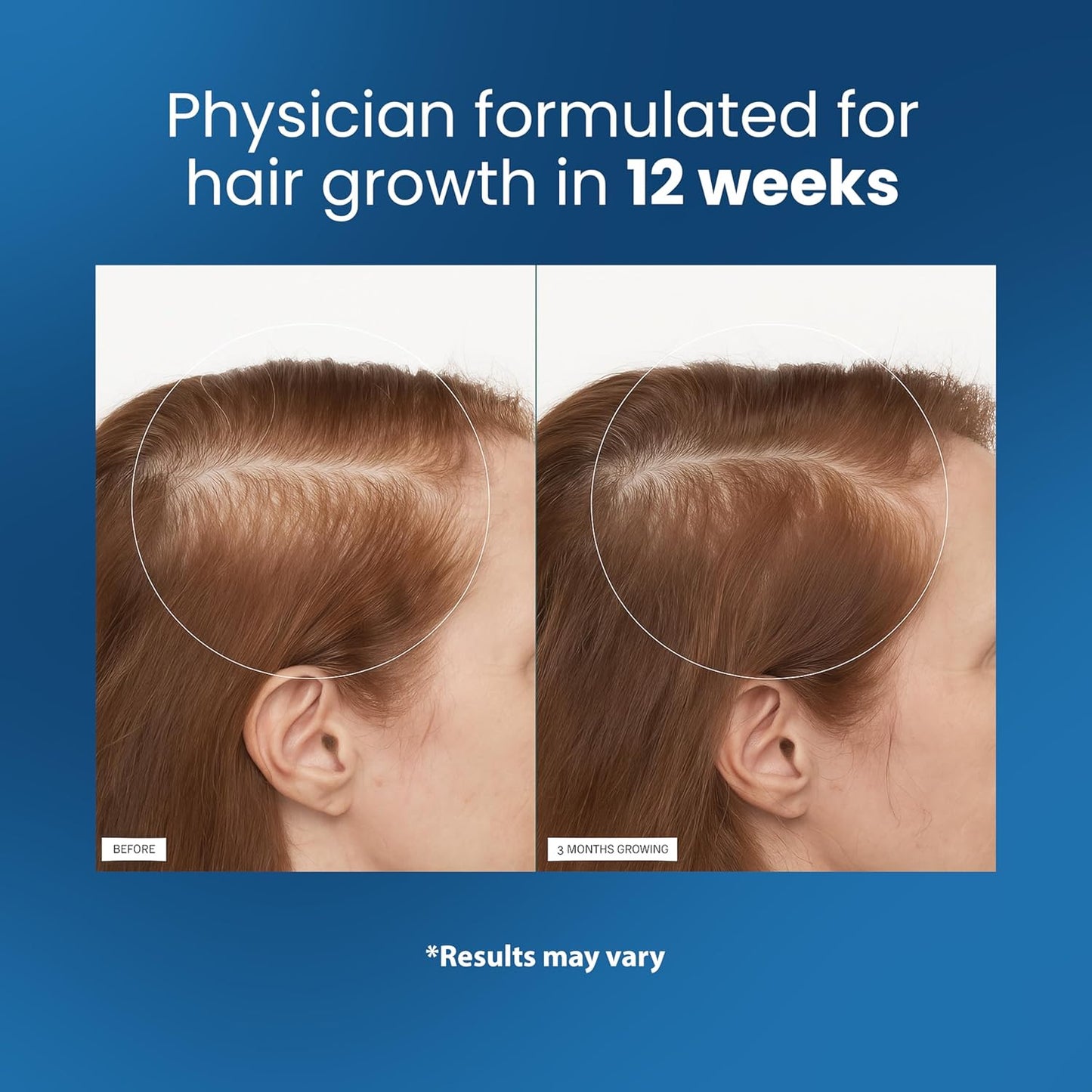 Hair Growth Roll-On Serum