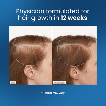 Hair Growth Roll-On Serum