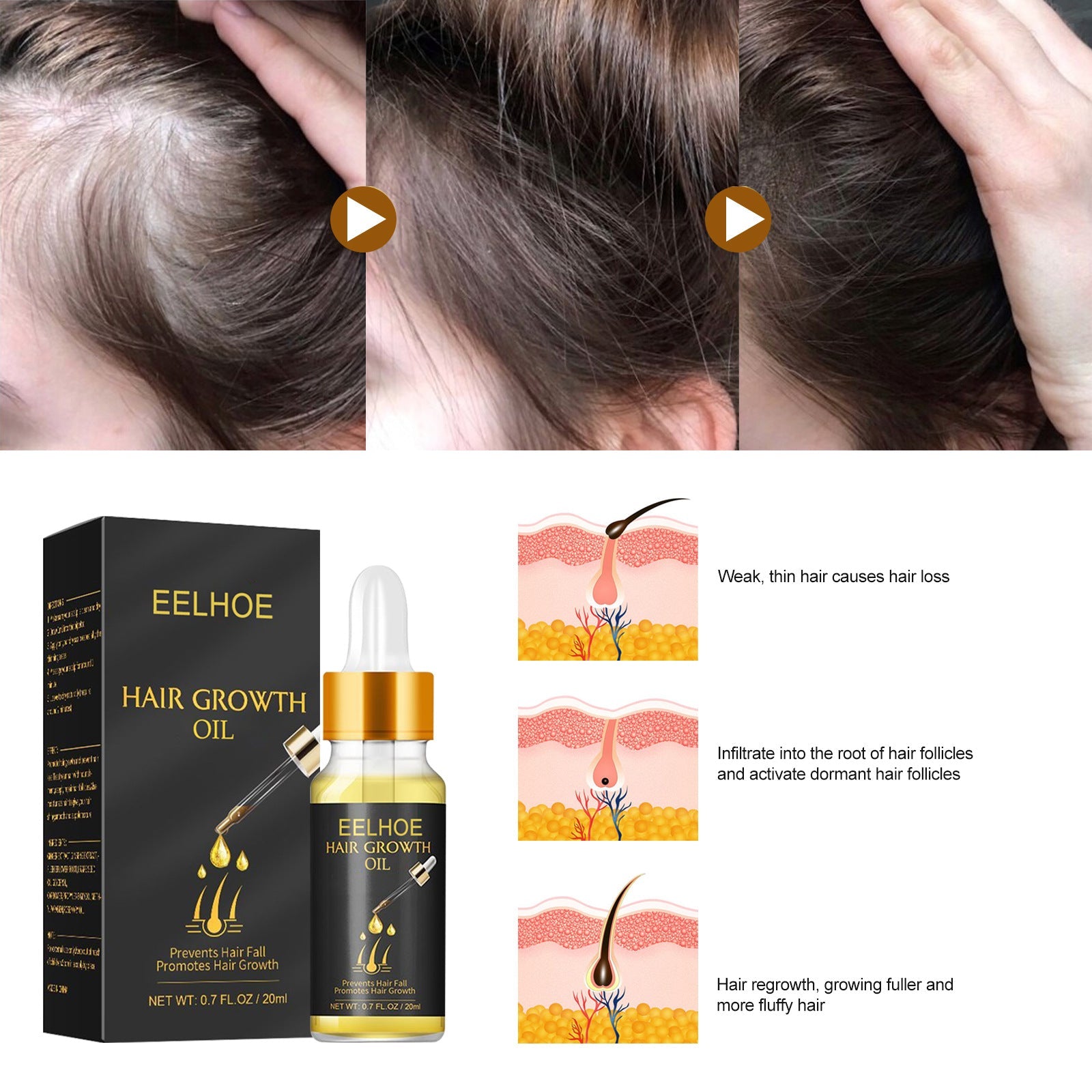 ScalpHealExperience fuller hair with ScalpHeal™ Hair Growth Oil. Nourish and rejuvenate your scalp for healthy hair growth.