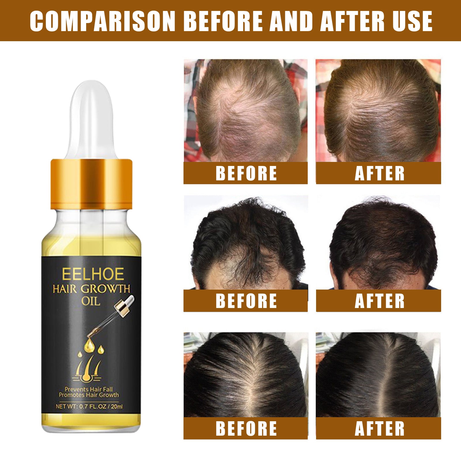 ScalpHealExperience fuller hair with ScalpHeal™ Hair Growth Oil. Nourish and rejuvenate your scalp for healthy hair growth.